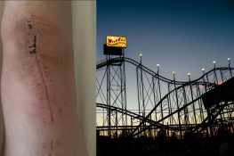 The knee-replacement rehab rollercoaster