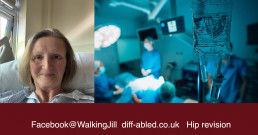 jill pringle and operating theatre diff-abled hip revision