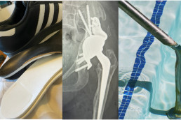 therapy images orthotics hydro pool Hip revision XRay diff-abled
